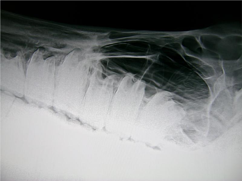 Røntgenbillede af tandrødder og bihuler